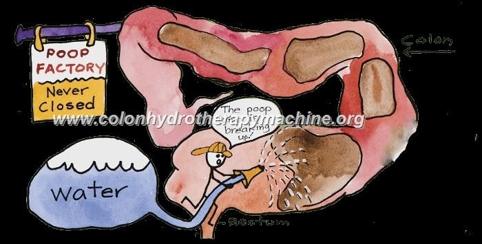 Cleansing Colon Machines