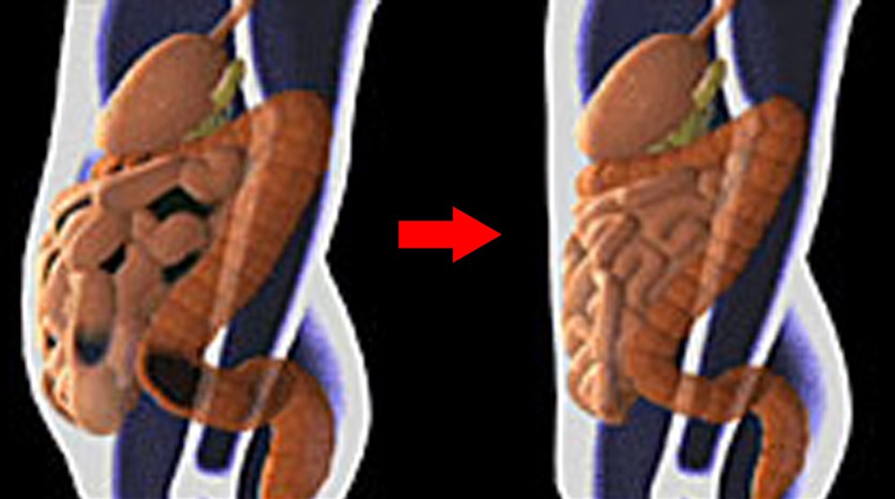 Medical Colon Cleanse Machine 129