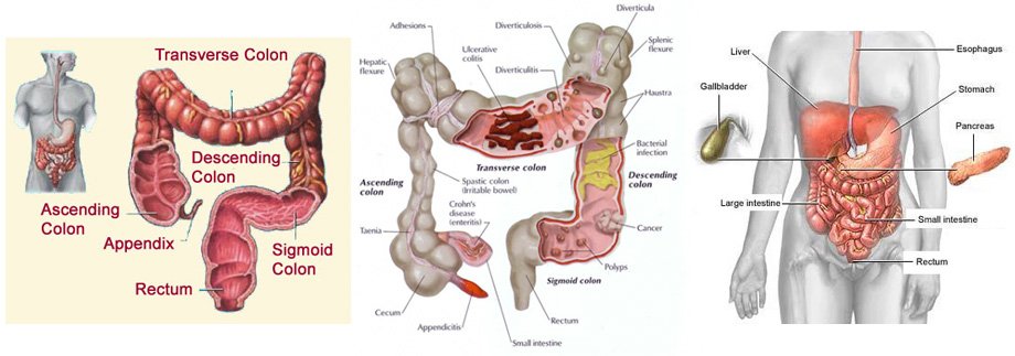 Medical Colon Cleanse Machine 133